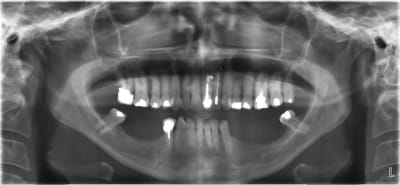 Pano origine nwhu2w - Eugenol
