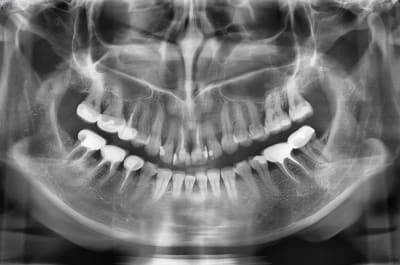 Pano t19dkp - Eugenol