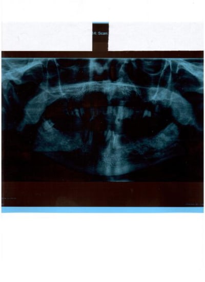 Pano tb3 001 bjxn2m - Eugenol