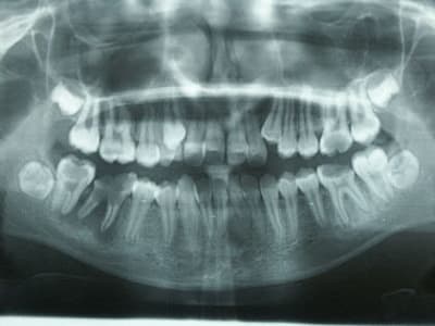 Pano txaxs1 - Eugenol
