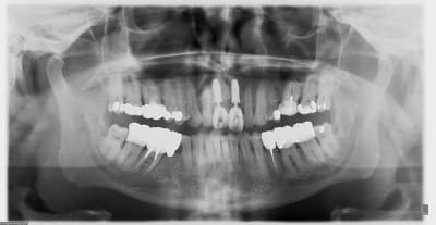 Pano u7x6bm - Eugenol