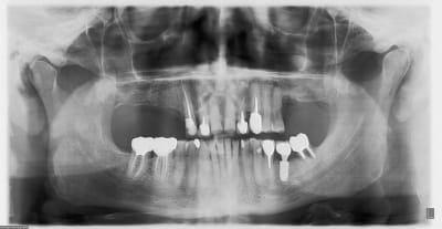 Pano uenvqy - Eugenol