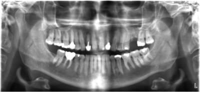 Pano w2vqyn - Eugenol