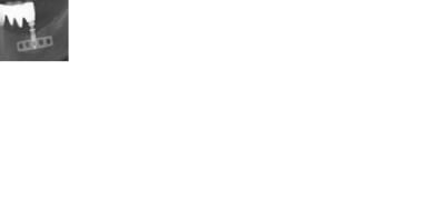 Pano ysxigw - Eugenol