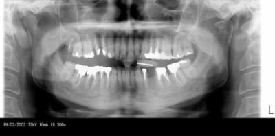 Panoramique99 iyf2gm - Eugenol