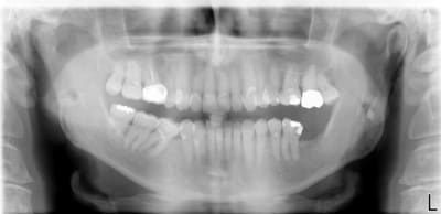 Panoramique bis vbvr79 - Eugenol