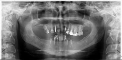Panoramique pf4ifp - Eugenol