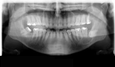 Panoramiquebellrd20103 iyzhxh - Eugenol