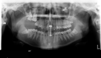 Panoramiquebellrd rwfhp7 - Eugenol