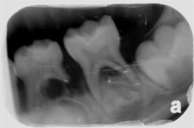Paro p do 2 udoc3y - Eugenol