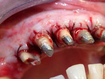 Paro secteur i ff2bzr - Eugenol