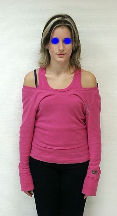 Patientedeface zyjdvf - Eugenol