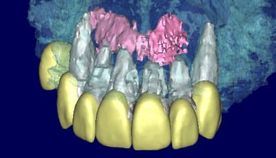 Patricia 3d2 kbvz9b - Eugenol