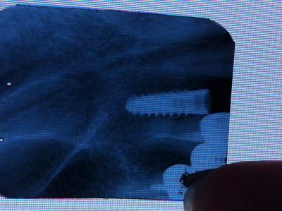 Pelicano w8nthu - Eugenol