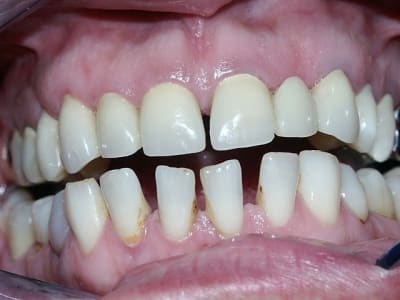 Pendant l3xwwu - Eugenol