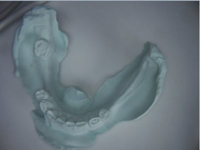 Peng 5 blpmdv - Eugenol