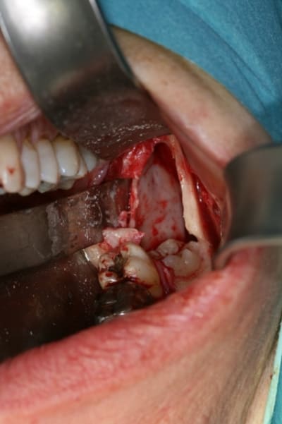 Per op2 y5oe7f - Eugenol