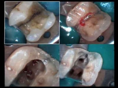 Perdue or not perdue 2 qxhzgp - Eugenol