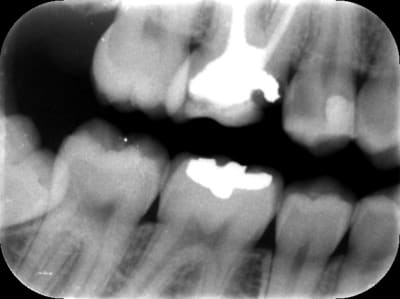Pessina gffxcg - Eugenol