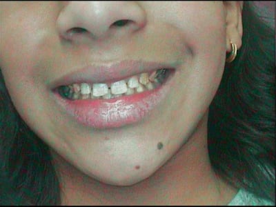 Petite3 n92i6m - Eugenol