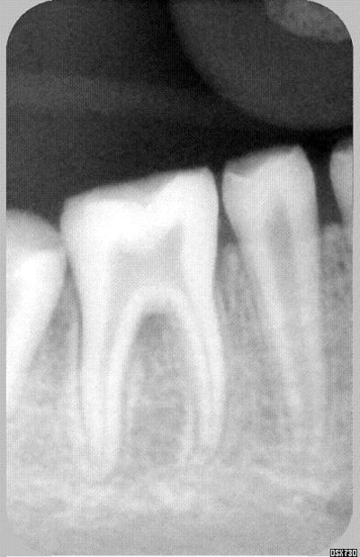 Petite mnqwiw - Eugenol