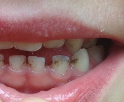 Photo 12  ekfybf - Eugenol