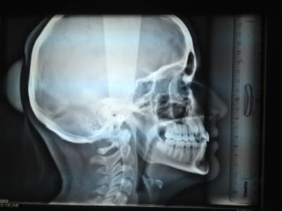 Photo 1 9  bp6unv - Eugenol