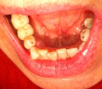 Photo 1  wrtrmk - Eugenol