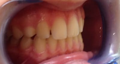 Photo 2 7  iuftkf - Eugenol