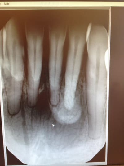 Photo 2 dwoinq - Eugenol