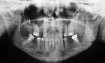 Photo 4 fycqcu - Eugenol