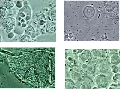 Photo bacterie e5ef5g - Eugenol