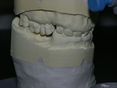 Pict0260 ltdq9g - Eugenol