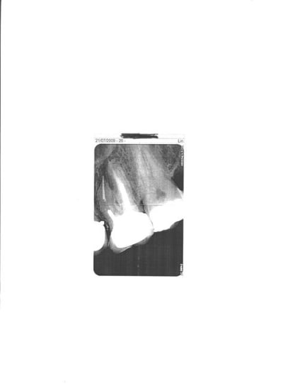 Piece jointe us2dgf - Eugenol