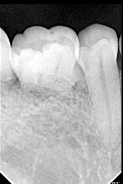 Pier nquew6 - Eugenol