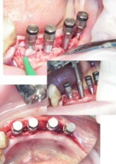 Planche2 f1xyig - Eugenol