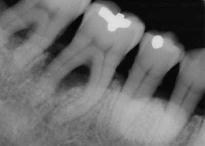 Plftrvk5ys23kynryqoy - Eugenol