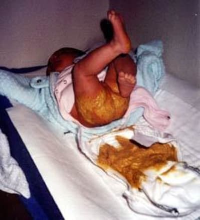 Pop dans le caca zm5wy9 - Eugenol