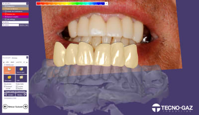 Posto 2 a8ljdf - Eugenol