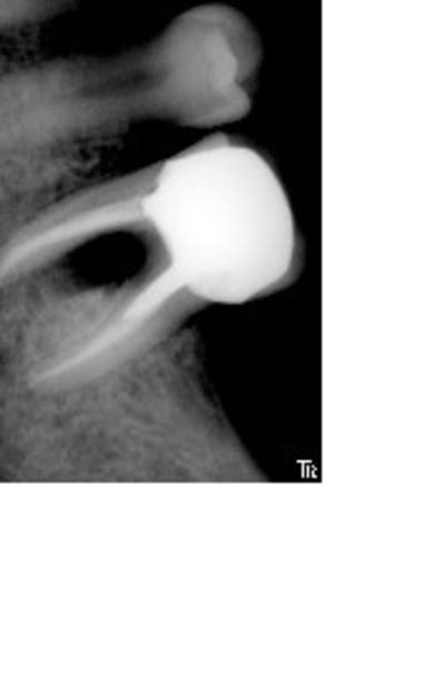 Postop1an2 ss3657 - Eugenol
