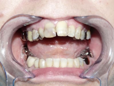 Pr  op md4ihp - Eugenol