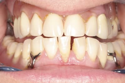 Pr  op qxxcpi - Eugenol