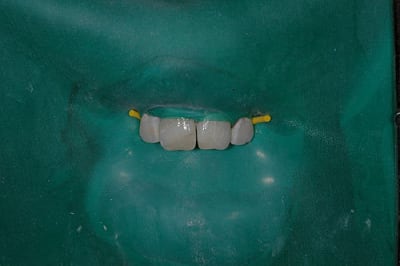 Presquefini zpu7vx - Eugenol