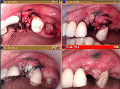 Prf1 tjrxxw - Eugenol
