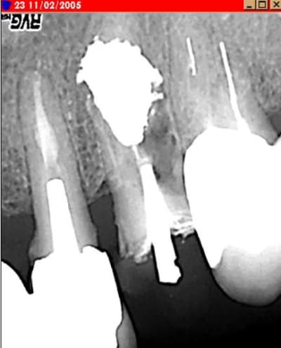 Prf2 att8ou - Eugenol