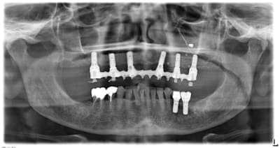 Proust a 20120920 2294 mngsvi - Eugenol