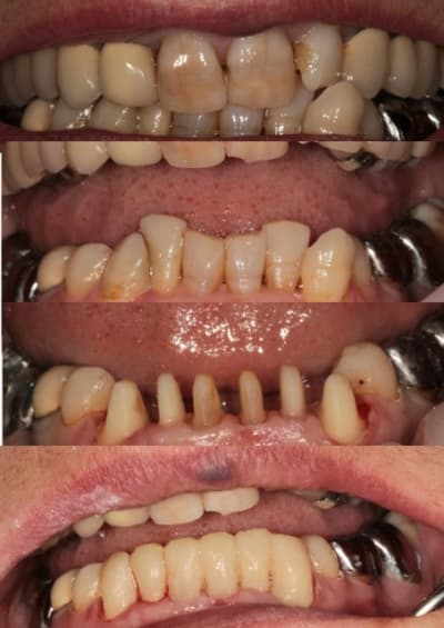 Provisore xfvple - Eugenol