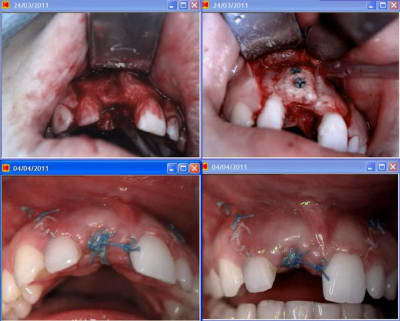 Puros z5hs3n - Eugenol