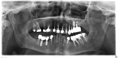 Pyrtb7ihebkfikg96x9k - Eugenol