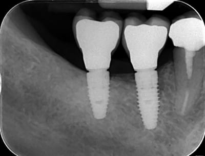 Q2ssq897tep6sglymgap - Eugenol